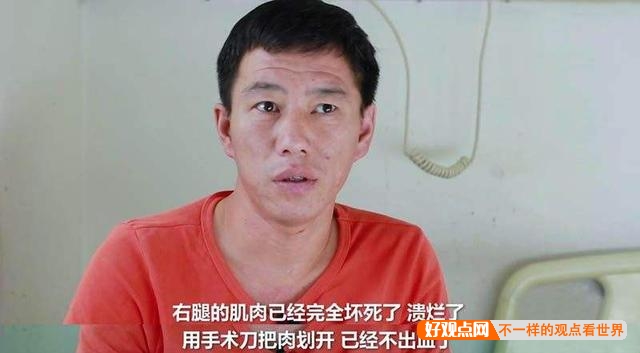 核辐射的威力堪比原子弹，人被核辐射以后会怎样？插图9