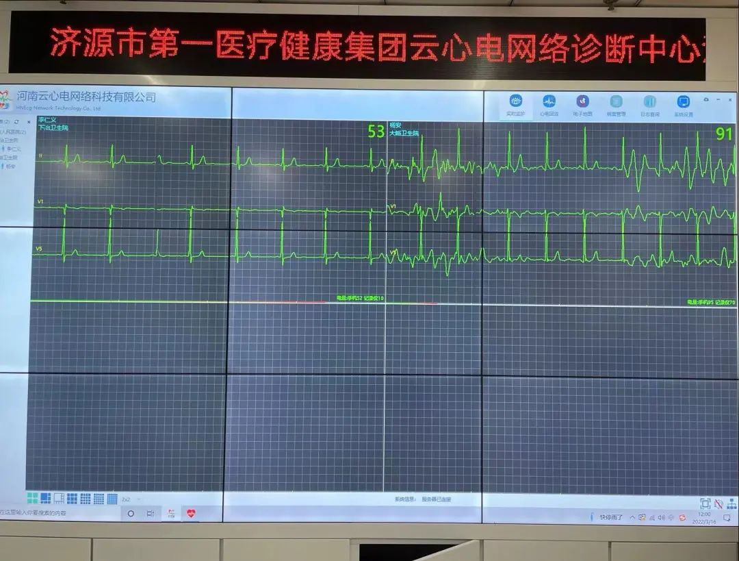 远程动态心电图是什么意思_做远程动态心电的公司_远程动态心电图能检查出什么病