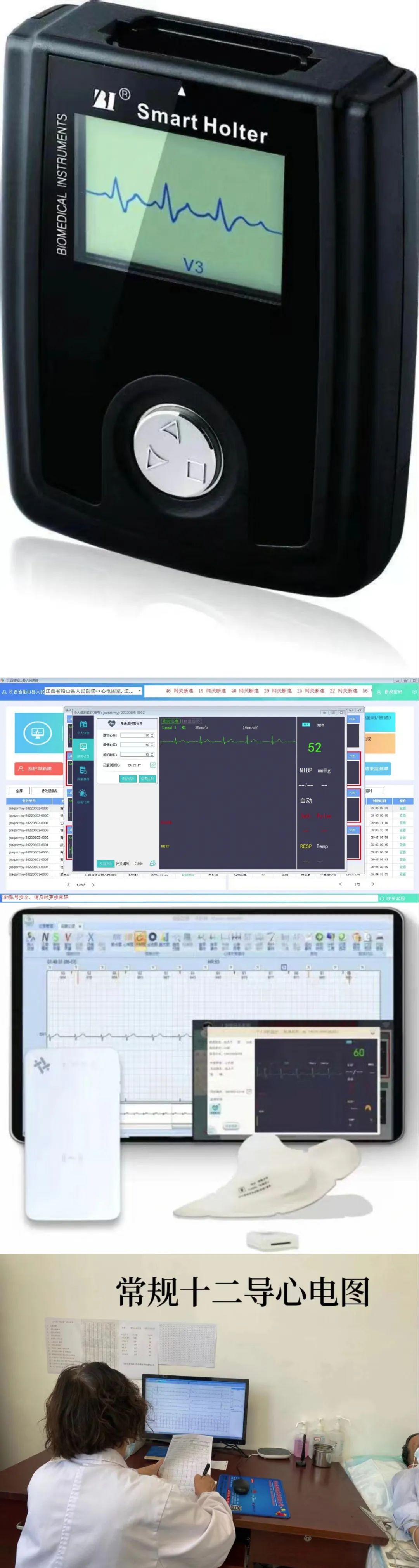 动态心电诊断标准_动态心电图诊断书_心电动态诊断公司