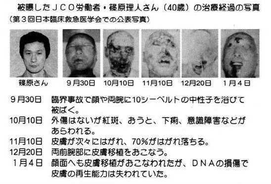 核废料的放射性可以用一般_放射性核废料的处理数学模型_核能放射性废物处理