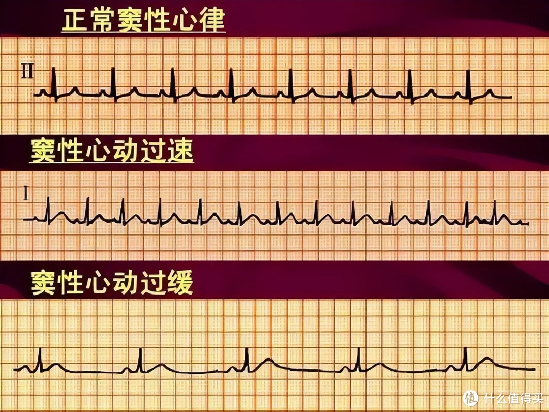 心电图异常，还能买保险吗？