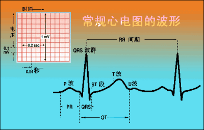 动态心电图软件新进展_动态心电图壁纸_动态心电图软件公司