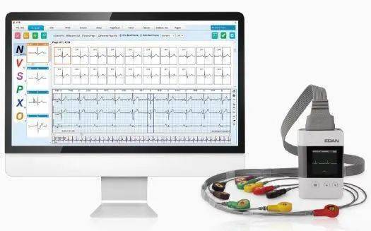 动态心电诊断标准_动态心电图诊断书_心电动态诊断公司